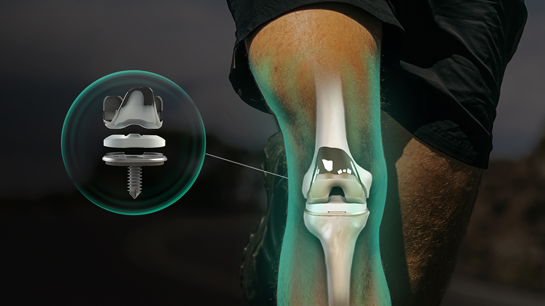 Monogram Orthopedics